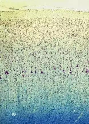 馬斯克腦機融合系統(tǒng)Neuralink